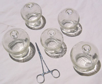 Chinese Medicine Cupping