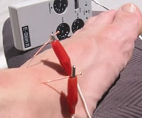 Electro-Acupuncture treatment