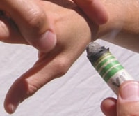 Moxibustion treatment